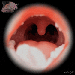 Succion de la gorge (uniquement sur tête silicone)